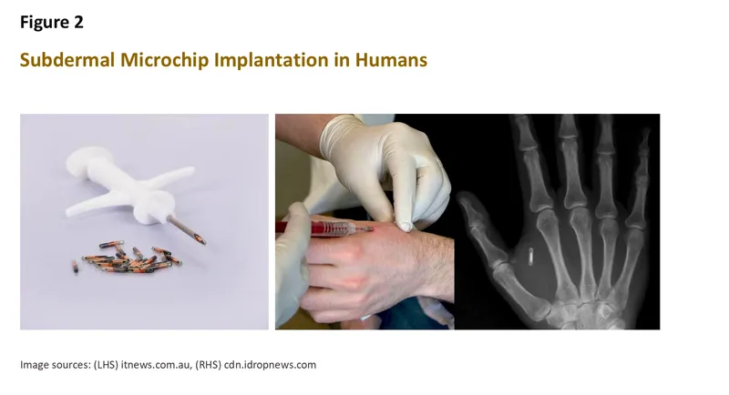 Microchip Implants